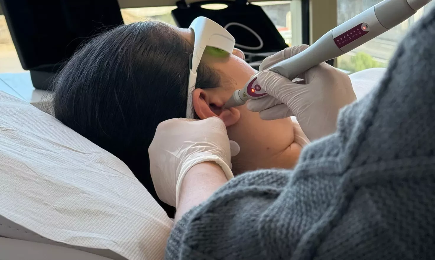 Séance laser auriculaire Montpellier Euphoria Laser